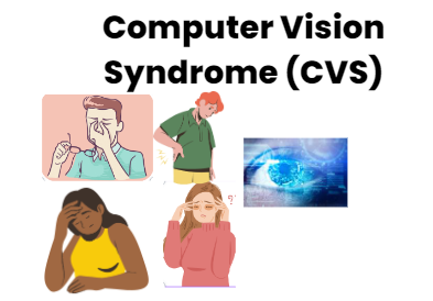 What is Computer Vision Syndrome